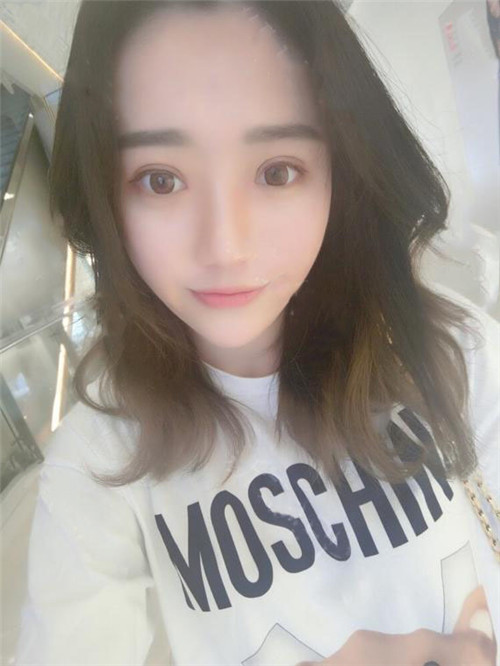 北京叶子汪环割双眼皮怎么样?案例_价格