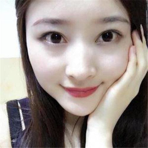 上海伯思立徐晓斐割双眼皮怎么样?案例_价格