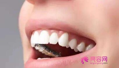 赫章县人民医院口腔科设备先进吗？附上牙齿矫正真实案例分享！