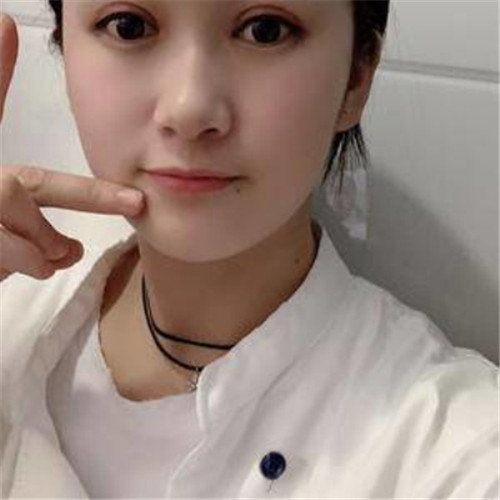 上海华美董亮割双眼皮怎么样?案例_价格