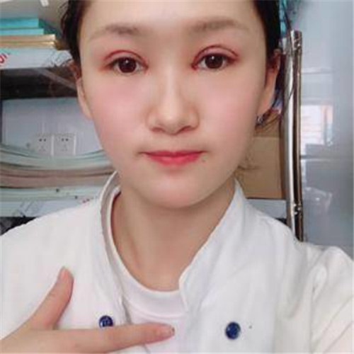 上海华美董亮割双眼皮怎么样?案例_价格