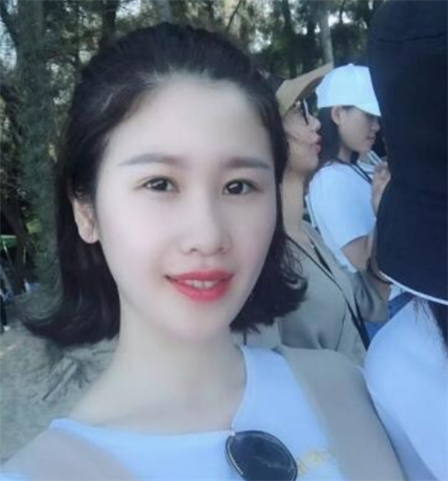 北京知音李奇军割双眼皮怎么样?案例_价格