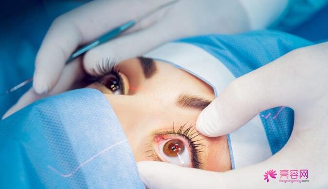 黔东南州人民医院眼科近视眼手术怎么样？眼科医生+近视矫正案例