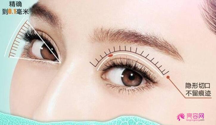 西京医院唐银科医生做双眼皮怎么样？医生详情+双眼皮手术前后对比