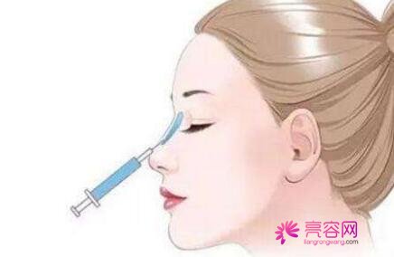 胶原蛋白隆鼻多少钱呀？影响价格的因素盘点，做胶原蛋白隆鼻案例
