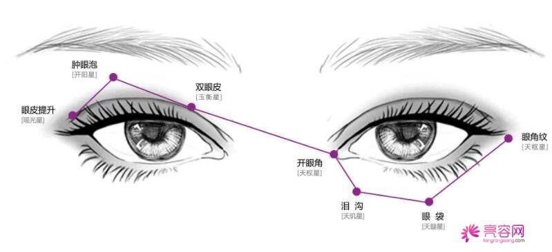 杭州艺星医疗美容医院李慧玲医生做双眼皮怎么样？双眼皮案例别错过！