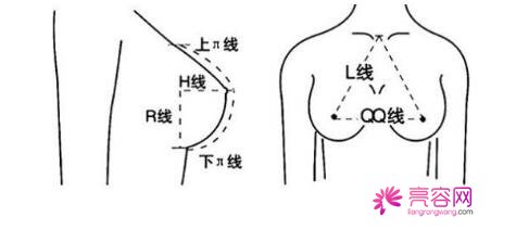 假体渗漏