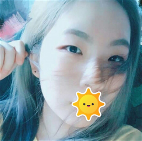 北京克莱美舍割双眼皮怎么样?案例_多少钱_口碑