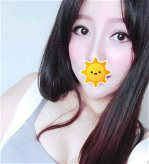 北京克莱美舍割双眼皮怎么样?案例_多少钱_口碑