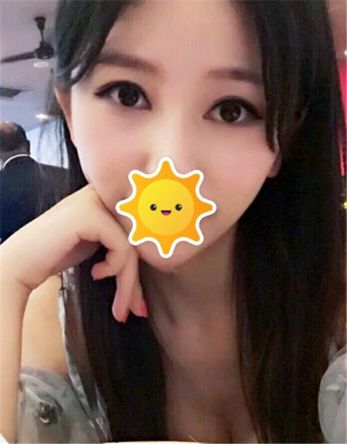 北京克莱美舍割双眼皮怎么样?案例_多少钱_口碑