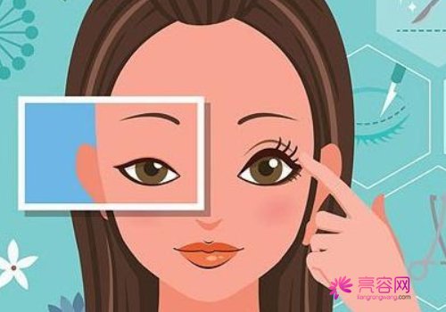 双眼皮手术后必须用祛疤的药吗？怎样避免留疤呢？双眼皮术后该怎么护理？