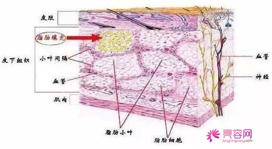 面部填充