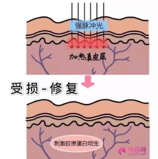 广州市红十字会医院整形激光美容中心怎么样？2021年价格表|医生信息