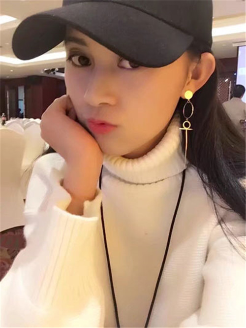 上海联合丽格成浩割双眼皮怎么样?案例_多少钱_口碑