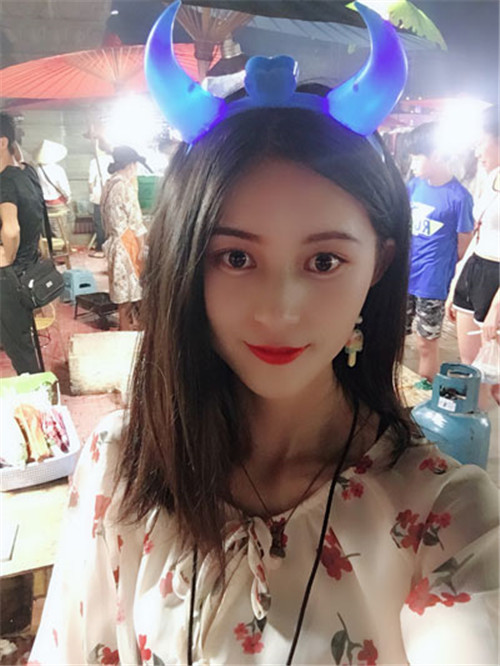 上海联合丽格成浩割双眼皮怎么样?案例_多少钱_口碑