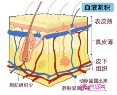 打嗨体熊猫有什么副作用？快来看看关于嗨体熊猫的详细介绍吧~