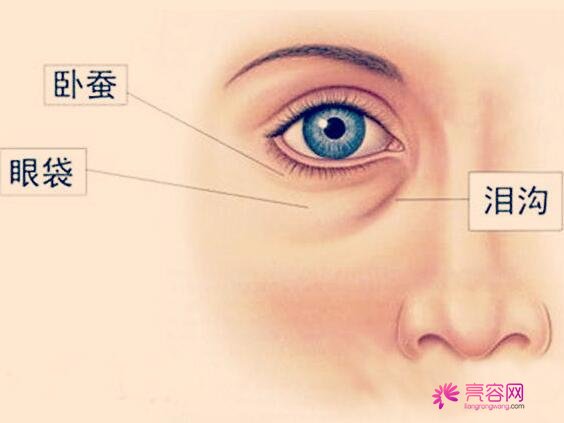 嗨体熊猫填充泪沟果怎么样？注射后的果让你意想不到