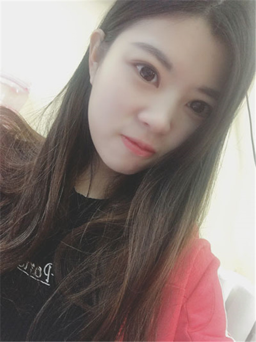 上海伯思立李茂群割双眼皮怎么样?案例_多少钱_口碑
