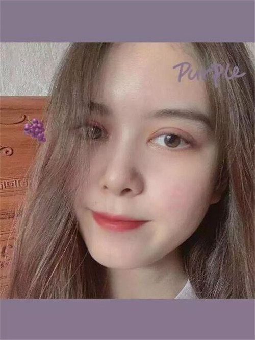 上海伯思立邵玉芳割双眼皮怎么样?案例_多少钱_口碑