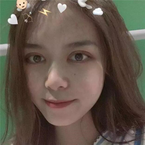 上海伯思立邵玉芳割双眼皮怎么样?案例_多少钱_口碑