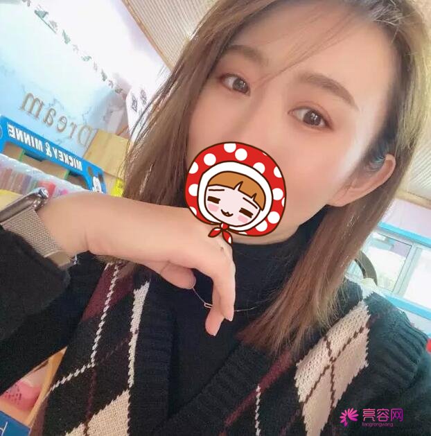下眼至整形图片对比，秒变无辜眼：想拥有漫画版“小鹿眼”吗？