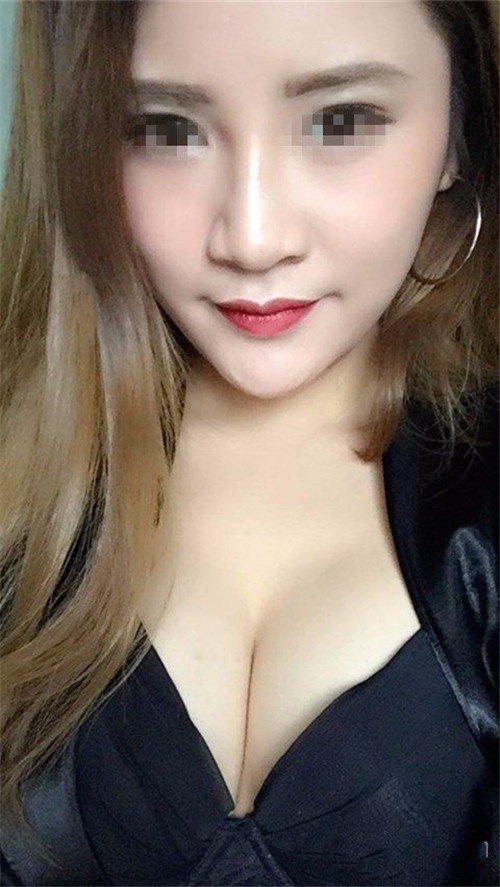北京韩啸侯泽明隆胸怎么样?多少钱_案例_口碑