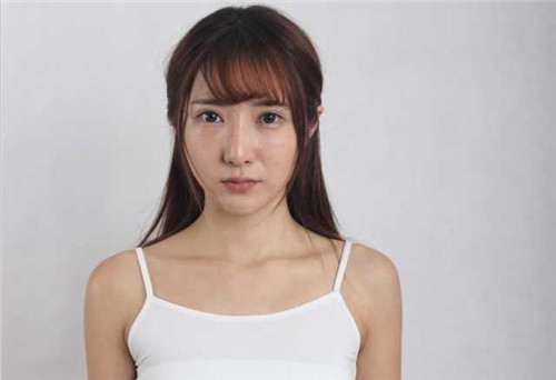 上海华美谢卫国隆胸怎么样?多少钱_案例_口碑