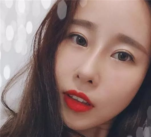 北京柏丽于海军隆鼻怎么样?多少钱_案例_口碑