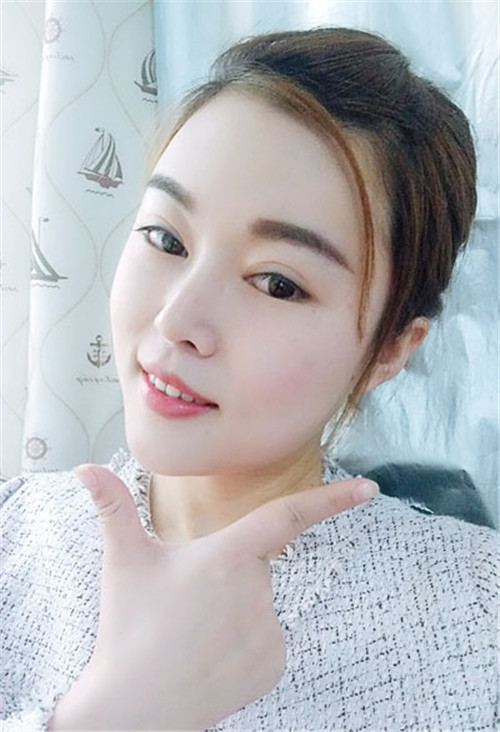 北京京民靳玉彪隆鼻怎么样?多少钱_案例_口碑