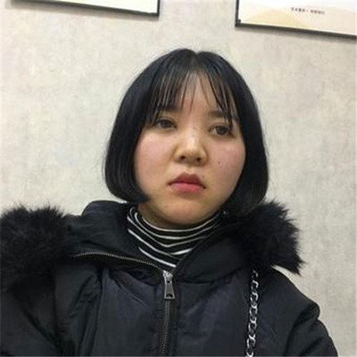 北京京民王志坚隆鼻怎么样?多少钱_案例_口碑