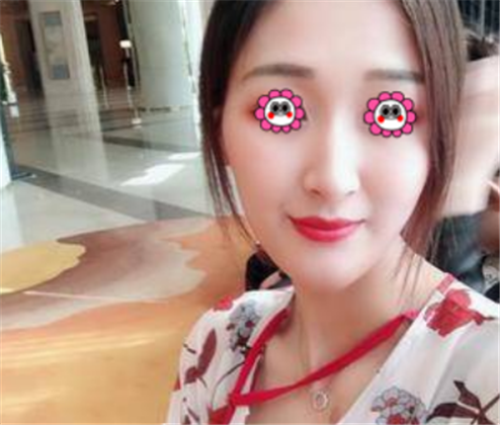 北京俊泰丽格薛志强隆鼻怎么样?多少钱_案例_口碑