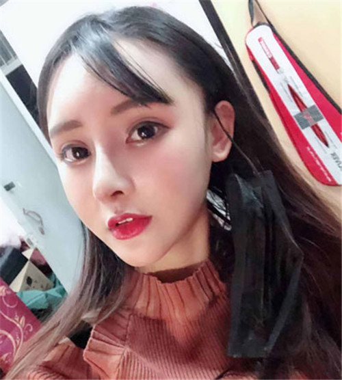 上海华美叶丽萍隆鼻怎么样?多少钱_案例_口碑