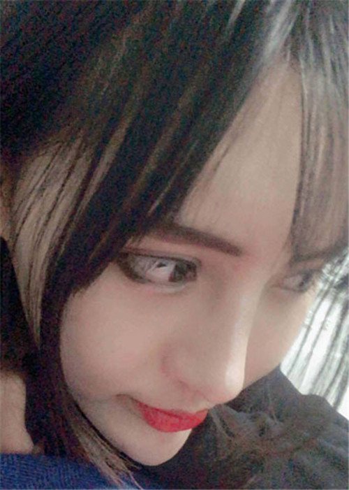 上海华美叶丽萍隆鼻怎么样?多少钱_案例_口碑
