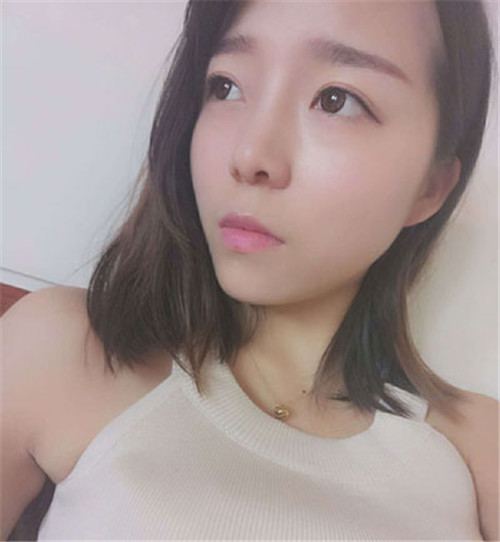 北京蕾士悦李海兵隆鼻怎么样?多少钱_案例_口碑