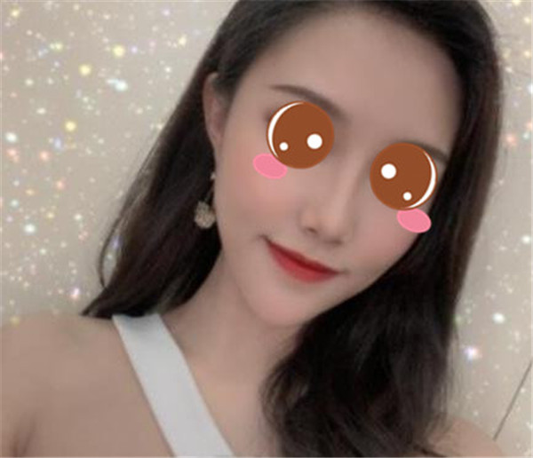 上海华美李健抽脂术后果怎么样?案例,价格,口碑