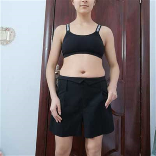 北京伟力嘉美信叶文珏抽脂术后果怎么样?案例,价格,口碑