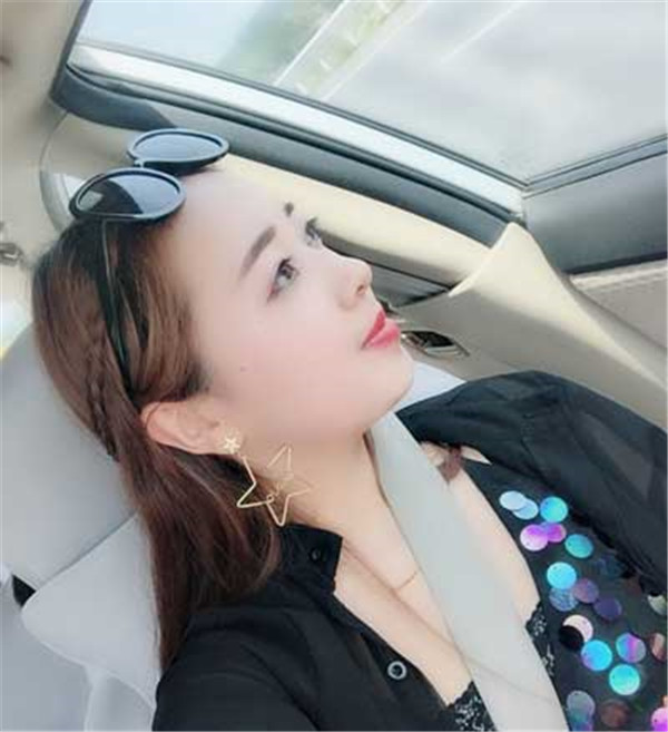北京禾美嘉韦辉抽脂术后果怎么样?案例,价格,口碑