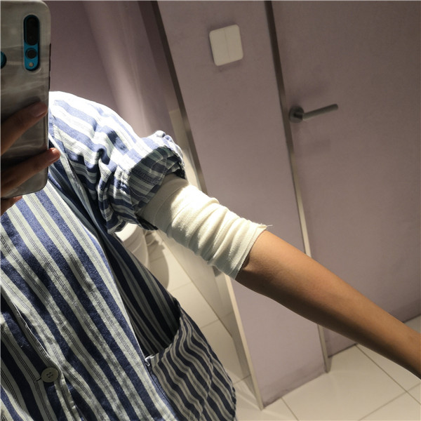 北京联合丽格陈万芳抽脂术后果怎么样?案例,价格,口碑