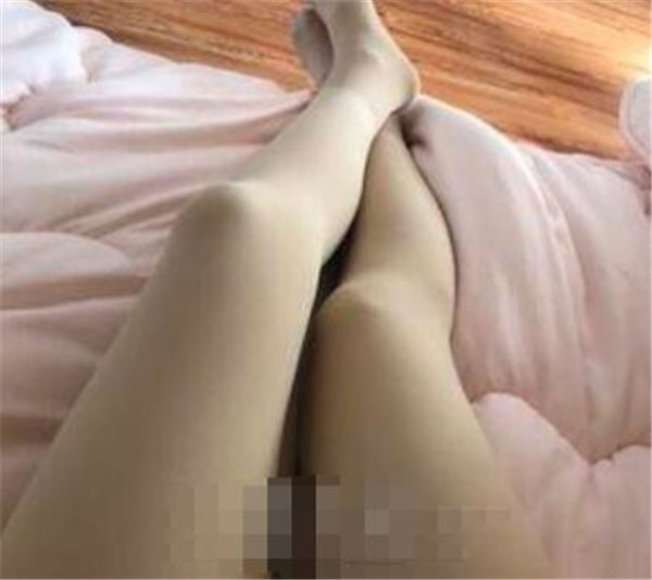 上海薇琳曹芳抽脂术后果怎么样?案例,价格,口碑