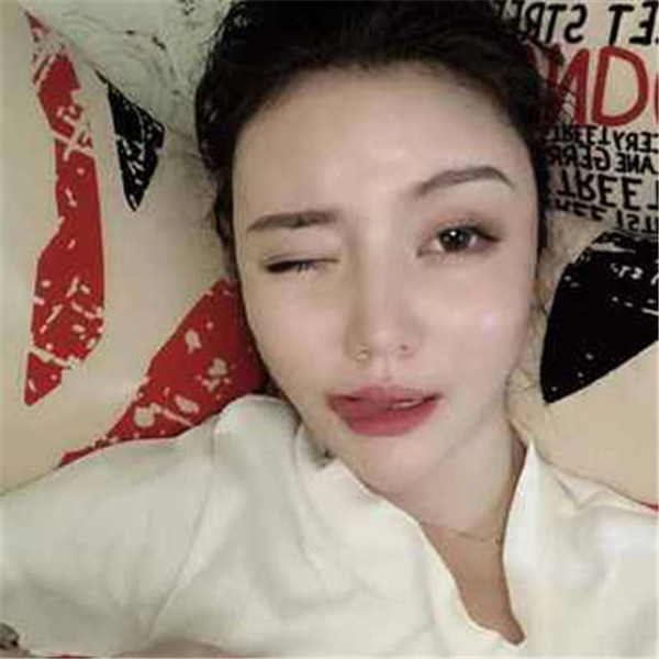 孙海如抽脂术后果怎么样?案例,价格,口碑