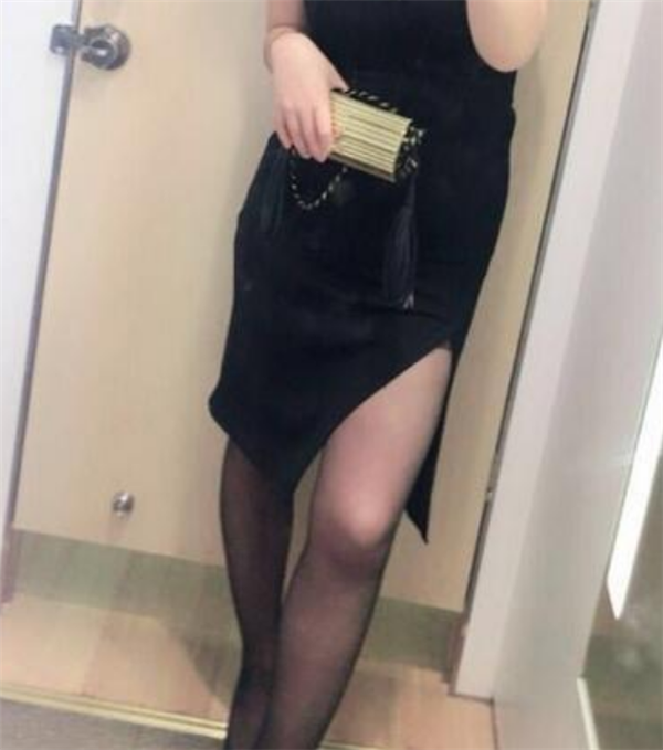 北京玉之光王明利抽脂术后果怎么样?案例,价格,口碑