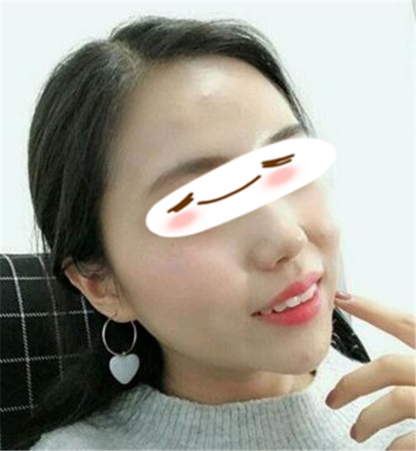 王志军抽脂术后果怎么样?案例,价格,口碑
