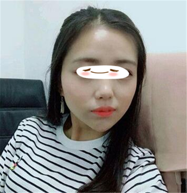 王志军抽脂术后果怎么样?案例,价格,口碑
