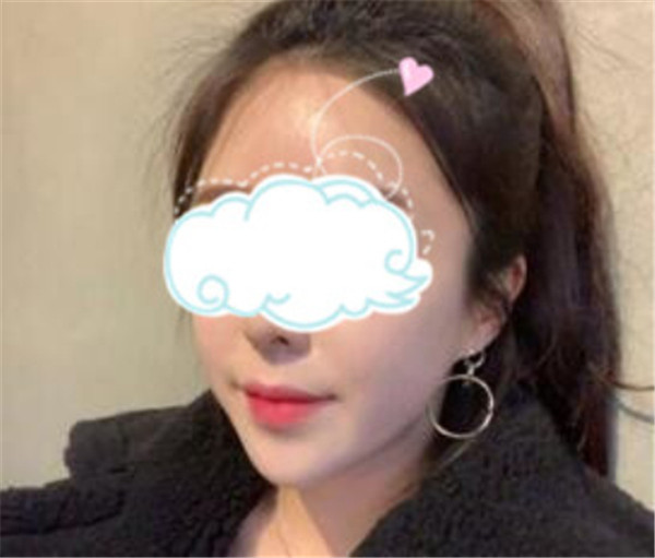 上海玫瑰张东旭抽脂术后果怎么样?案例,价格,口碑
