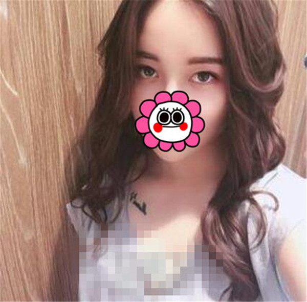 上海华美王荣锡抽脂术后果怎么样?案例,价格,口碑