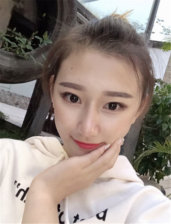 袁玉坤抽脂术后果怎么样?案例,价格,口碑