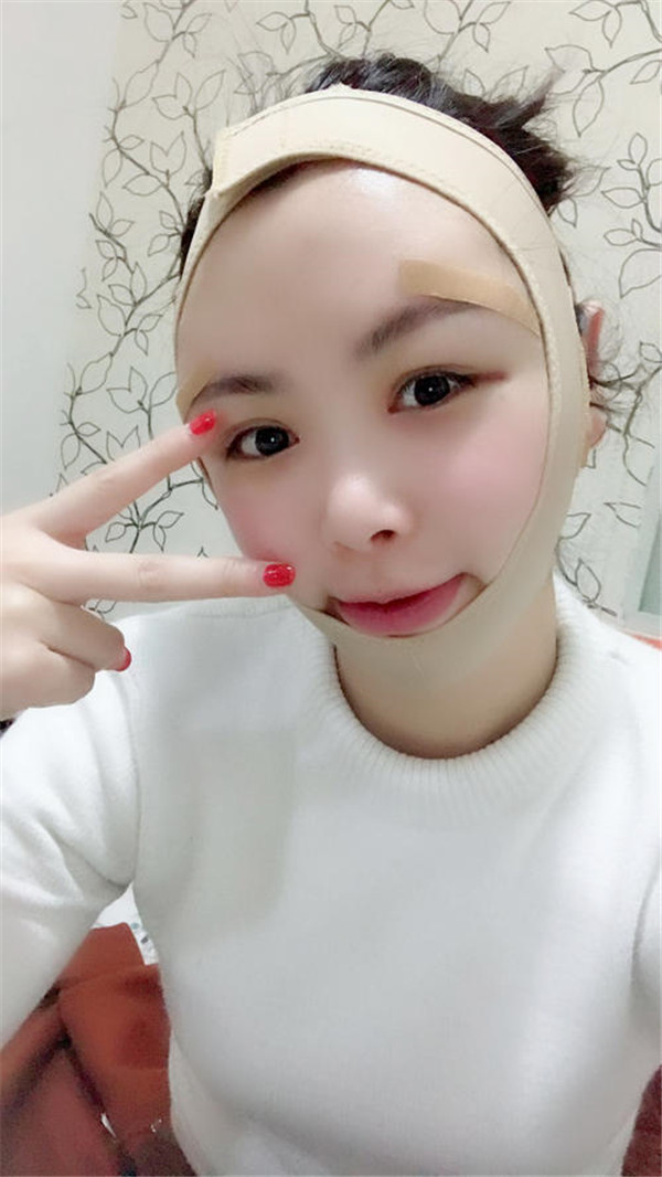 孙海如抽脂术后果怎么样?案例_价格