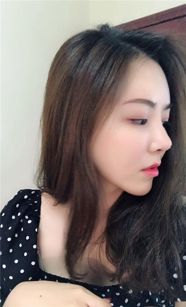 孙海如抽脂术后果怎么样?案例_价格